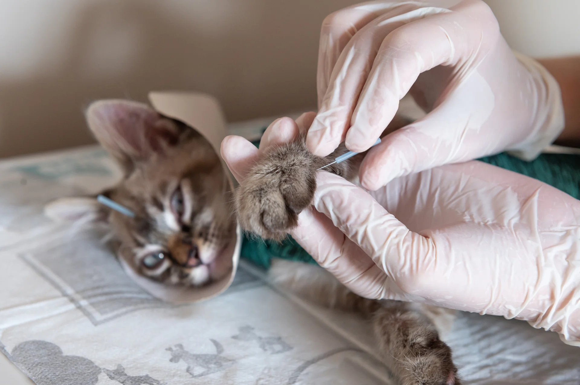 Acupuncture